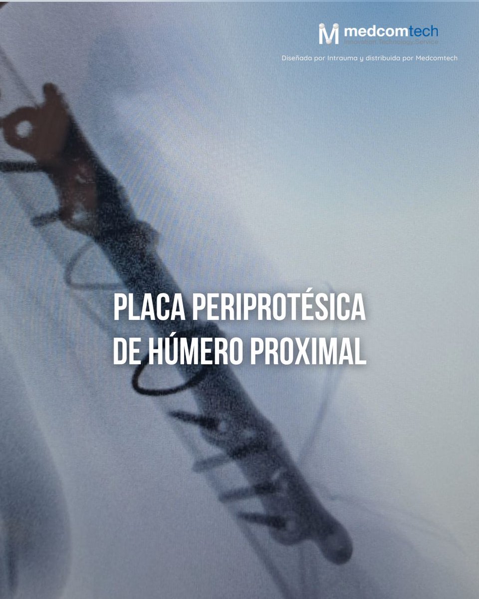 medcomtech_sa's tweet photo. Primer caso en el H. Arnau de Vilanova (Lleida) con placa periprotésica de húmero proximal de Intrauma. 
Intervención exitosa de la Dra. Bonjorn y el equipo EESS.
#traumatología #húmero #cirugíaortopédica #intrauma https://t.co/0NQu0Dyg3R