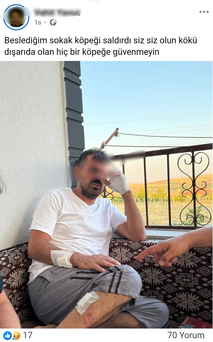 Bir vatandaş beslediği başıboş köpeklerin saldırısına uğradı.

Saldırıya uğrayan vatandaş:

"Siz, siz olun kökü dışarıda olan hiç bir köpeğe güvenmeyin" diyerek aldığı dersi paylaştı.