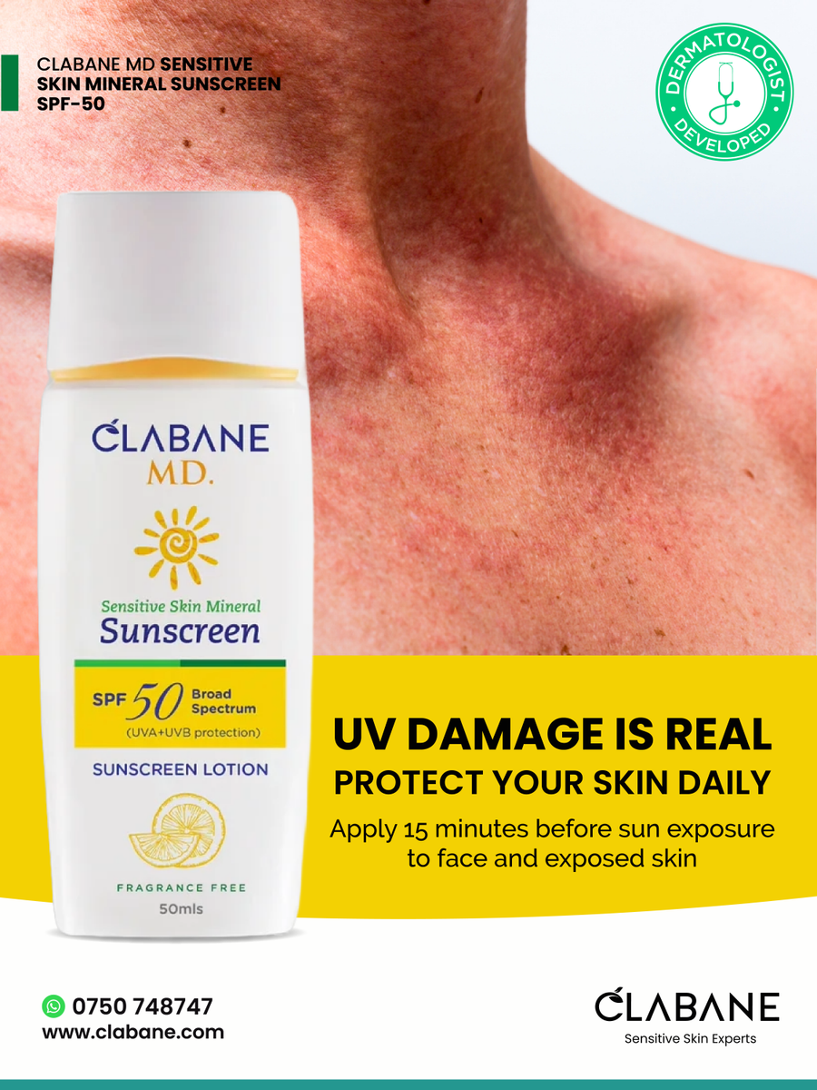 ClabaneSkinCare's tweet image. Guard against UV damage. Keep your skin soft and bright with Clabane MD sensitive skin Mineral Sunscreen SPF 50

#ClabaneOrganics #MineralSunscreen #SPF50 #RadiantSkin #AfricanSkinCare #GlowProtected #SkinCareThatWorks