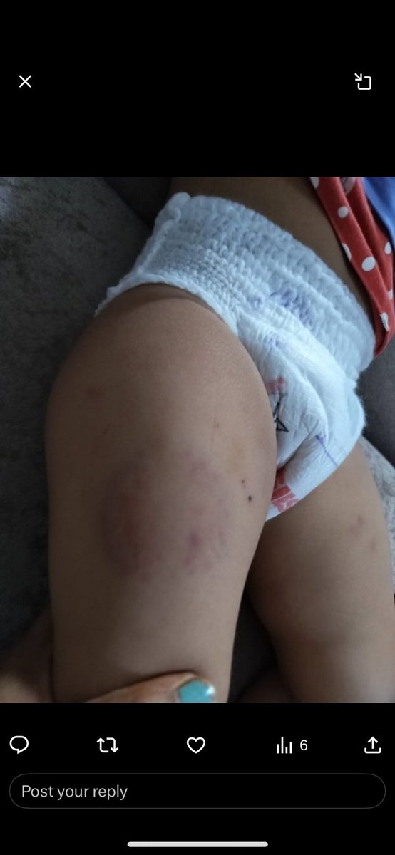 nidhirpatel6's tweet image. દિલ્લીના નોઈડામાં 15 મહિનાની માસૂમ બાળકી પર  Day care માં નિર્દયતા પૂર્વક અત્યાચાર..
બાળકી રોતી રહી અને મેડે મારી, દીવાલ પર પટકી, જમીન પર પછાડી, બચકા ભર્યા.. 
 
પુરી ઘટનાના CCTV આવ્યા સામે.. 

જીવ કઈ રીતે ચાલ્યો હશો આ સ્ત્રીનો ??