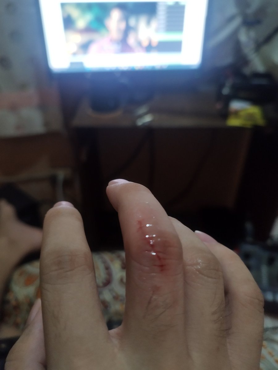 Ok so I decided to surprise my cat, guess who got surprised???

Bad. idea.