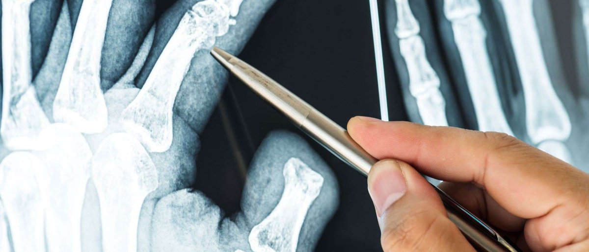 MU_MCW_BME's tweet image. Joint Dept. Asst. Professor Dr. Bo Wang is re-engineering #Bone and #Tissue outside of the body to be introduced as superagents of repair. You can learn more about her novel approach here: tinyurl.com/bddtts6w