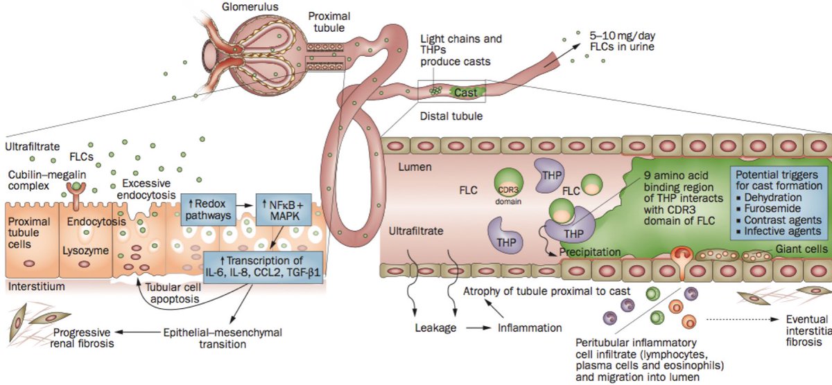Nephro_Ivan's tweet photo. Muy buena imagen de la fisiopatología del riñón de mieloma 
👏🏻👏🏻👏🏻👌🏻
@NatRevNeph https://t.co/Ll6A7xWX5p