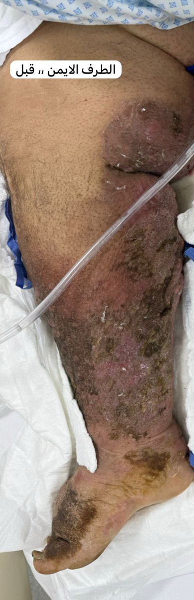 د.حسين باريان tweet media