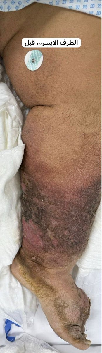 د.حسين باريان tweet media