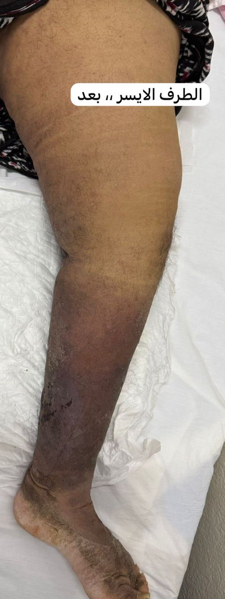 د.حسين باريان tweet media