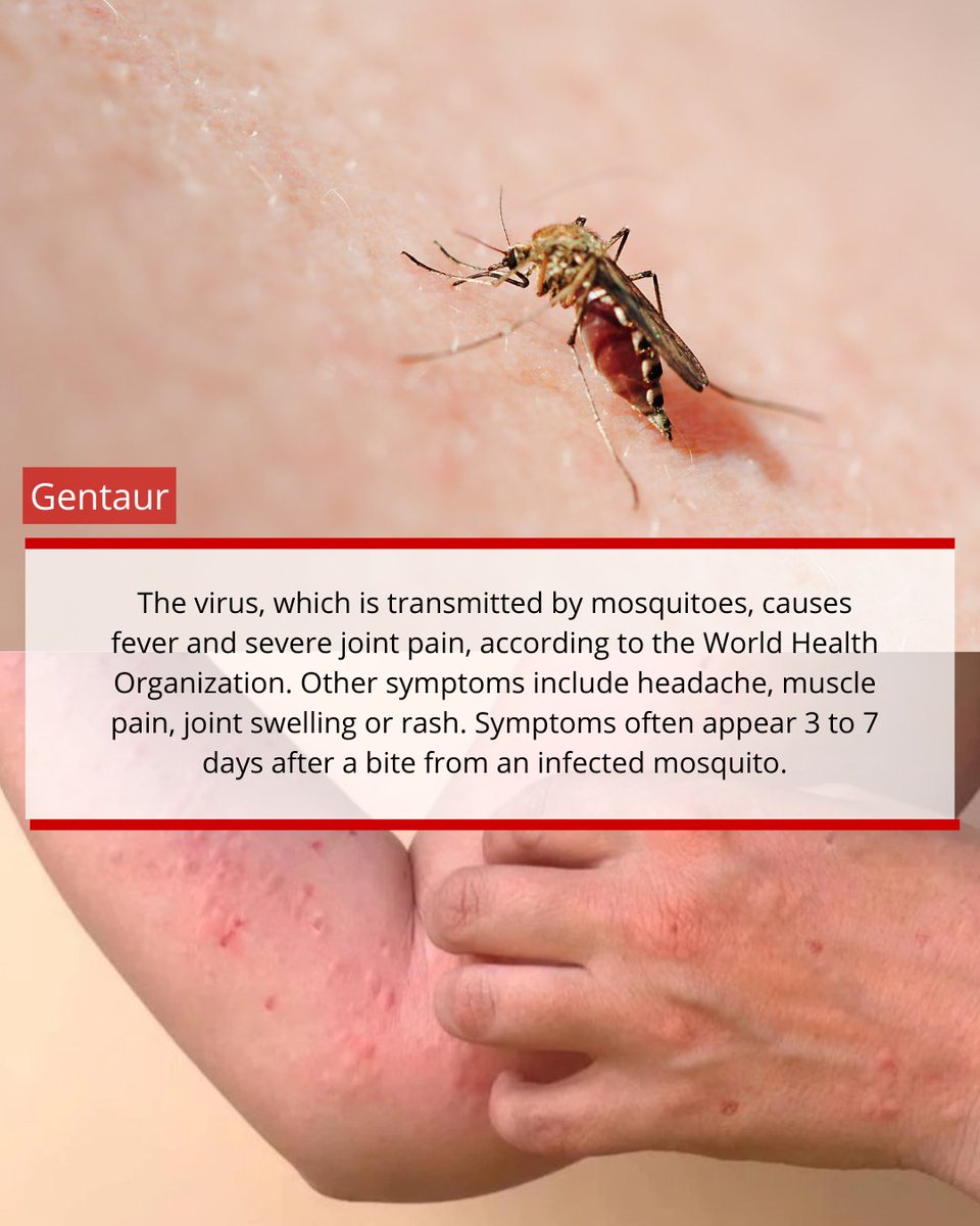 🚨 Ponad 7 000 przypadków wirusa Chikungunya w prowincji Guangdong w Chinach 🇨🇳. Chroń się!
#Chikungunya #Chiny #Wirus #AlarmZdrowotny #ZwalczanieKomarów