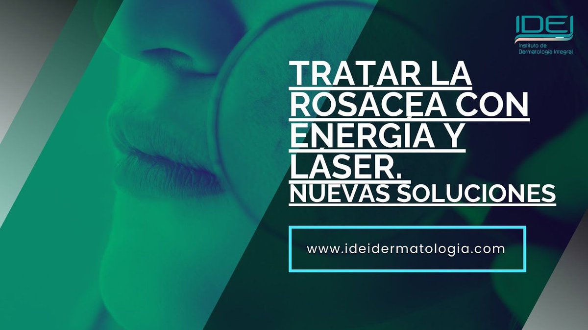 Tratar la #rosácea con energía y #láser. Nuevas soluciones. Lo cuenta el #DrSánchezViera en <a href="/CMM_es/">Castilla-La Mancha Media</a> 
youtube.com/watch?v=pGRXE2…