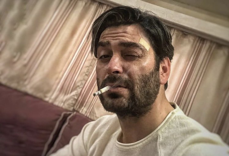 Benim Ozan’ın sigaralı fotoğraflarına olan zaaf