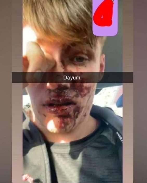 Elle 🇮🇪....💚🤍🧡 (@elle98759673) on Twitter photo Will <a href="/SimonHarrisTD/">Simon Harris TD</a> be calling a meeting with the
IRISH COMMUNITY in relation to the Foreign Mob that attacked this innocent Irish Lad in Adamstown..
I'll Wait....👍 Will <a href="/SimonHarrisTD/">Simon Harris TD</a> be calling a meeting with the
IRISH COMMUNITY in relation to the Foreign Mob that attacked this innocent Irish Lad in Adamstown..
I'll Wait....👍