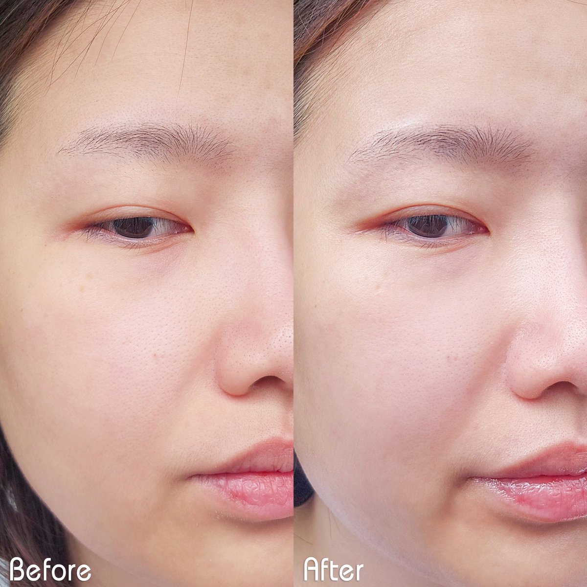 หลอดนี้คือหลอดที่แนะนำทุกคนตลอดว่าต้องมีติดไว้ จะผิวแห้ง หน้าลอก รูขุมขนกว้าง ผิวแพ้ แดง จากการเสียสมดุล-ความชุ่มชื้น ใช้ CICAPLAST BAUME B5+ ของ La Roche-Posay รู้สึกเลยว่าผิวแข็งแรง เวลาโดนแดดแสบร้อนน้อยลง ผิวกักเก็บความชุ่มชื้นได้ยาวนานขึ้น ใช้คู่กับเซรั่มลดรอยแล้วจางไวมากกก