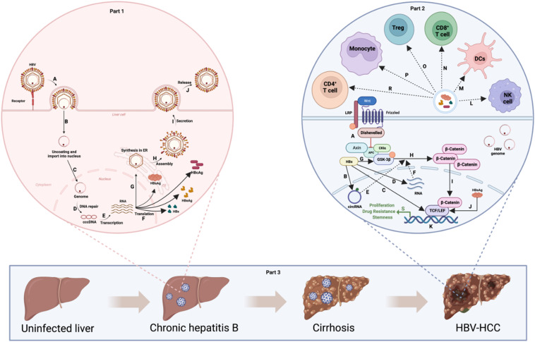 Genes & Diseases Journal (@genesndiseases) on Twitter photo This review details circRNA biogenesis and their role in HBV-induced HCC, highlighting therapeutic potential, past research advances, and current methodological challenges, offering insights to guide future investigations. <a href="/nazri_mustaffa/">Nazri Mustaffa</a> <a href="/medicalusm/">Medical School USM</a> @USMOfficial1969
#OpenAccess: This review details circRNA biogenesis and their role in HBV-induced HCC, highlighting therapeutic potential, past research advances, and current methodological challenges, offering insights to guide future investigations. <a href="/nazri_mustaffa/">Nazri Mustaffa</a> <a href="/medicalusm/">Medical School USM</a> @USMOfficial1969
#OpenAccess: