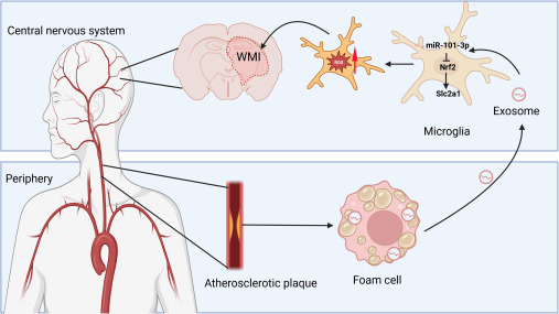 Foam cell-derived exosomes: Messengers between atherosclerosis and microglia dlvr.it/TMQcSf