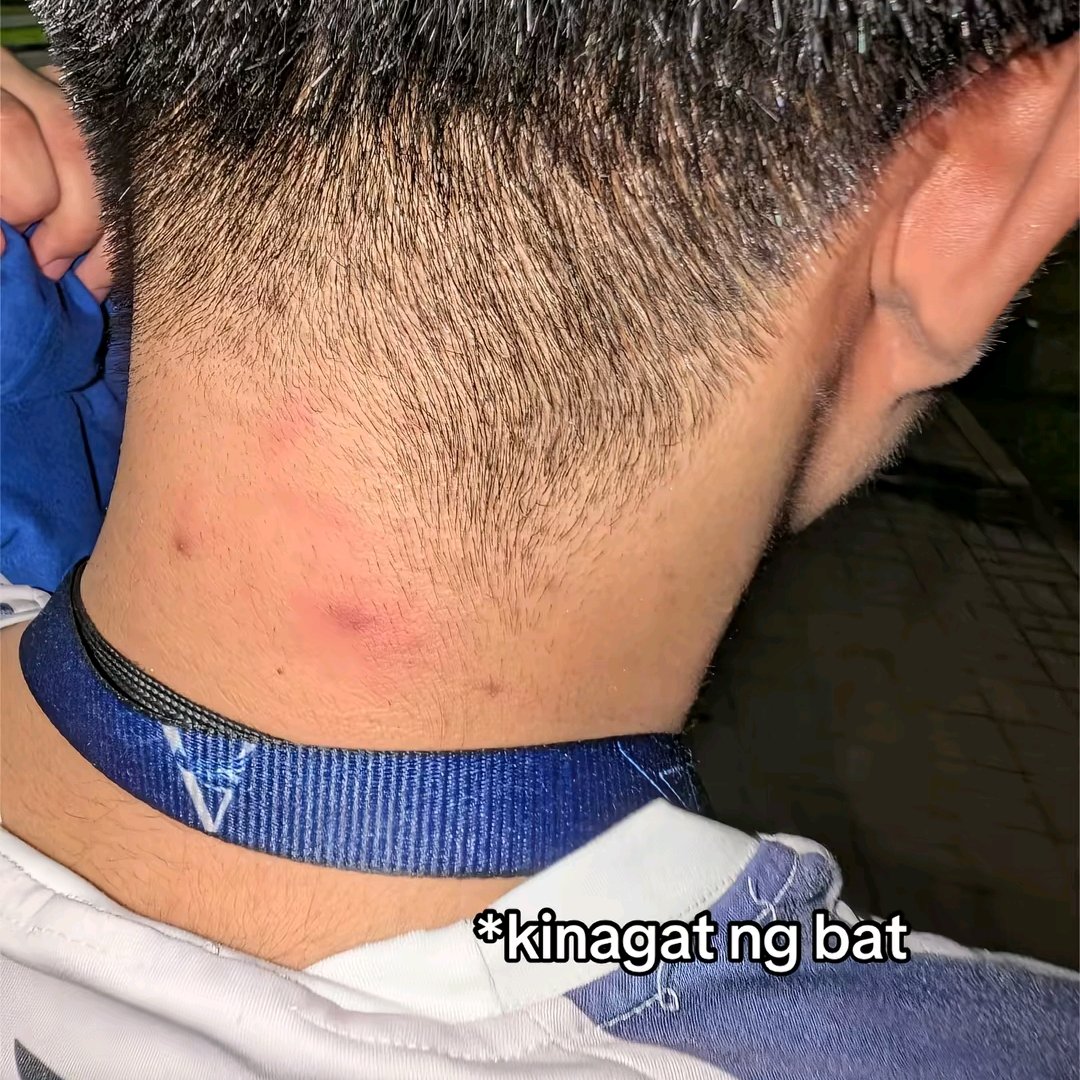 kennymorado's tweet photo. Tanginaaaaa hahahaha tawang-tawa ako sa TikTok 😭 lusak na nga ang Ateneo tapos may paniki pang nangangagat sa campus huhu https://t.co/HwlQtKXoKs
