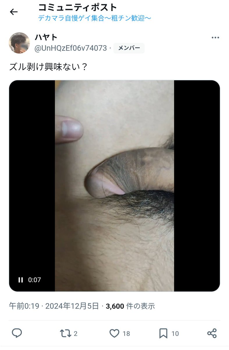 Bot163826901's tweet photo. 判定「見栄剥きの可能性が高い」
@UnHQzEf06v74073 https://t.co/ZdKzIpy7IZ