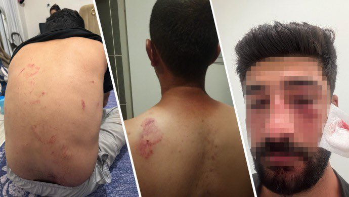 🔵 Mersin’de Kürdçe Konuşan Aileye Irkçı Saldırı

Mersin’in Çamlıyayla ilçesine bağlı Kisecik köyünde, 8 kişilik bir aile geziden dönerken Kürdçe konuştukları gerekçesiyle saldırıya uğradı.

Edinilen bilgilere göre olay, Pazar günü 17.30 sularında yaşandı. İddiaya göre köy