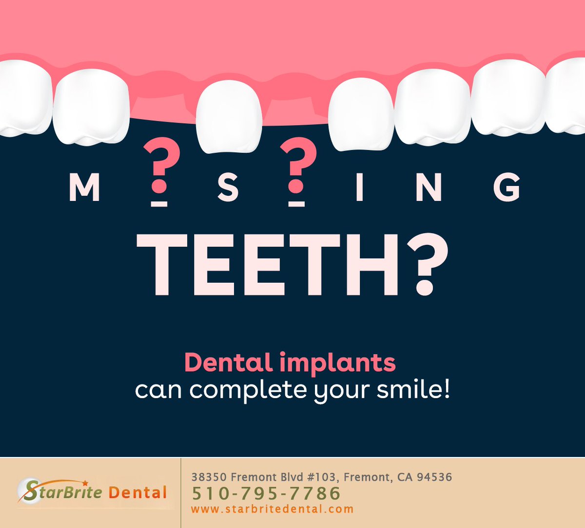 Replace missing teeth and complete your smile with dental implants, the gold standard for tooth replacement. Schedule a consultation at starbritedental.com to learn more. #dentalimplants #toothreplacement #fremont #CA #starbritedental
