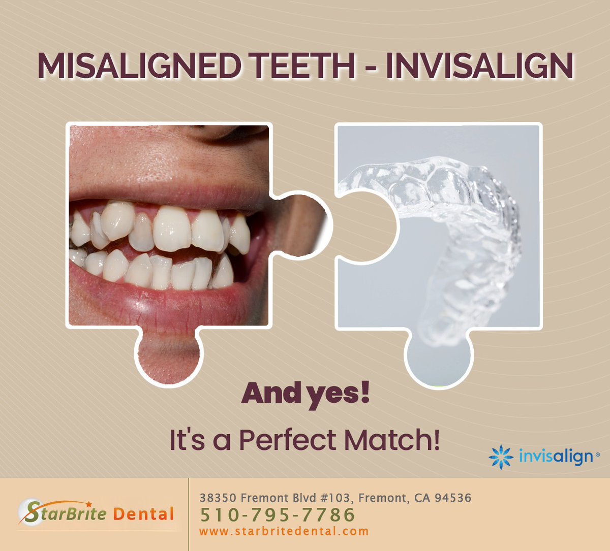 Straighten your teeth and achieve your ideal smile while maintaining your appearance. Invisalign offers a personalized solution for crowding, spacing, and mild bite issues. Call 510-795-7786 today. #invisalign #fremont #CA #starbritedental