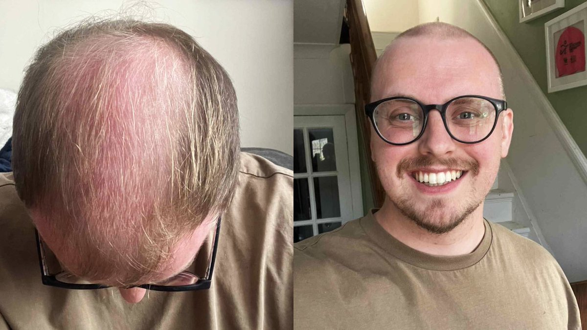 Snake Beater tweet media