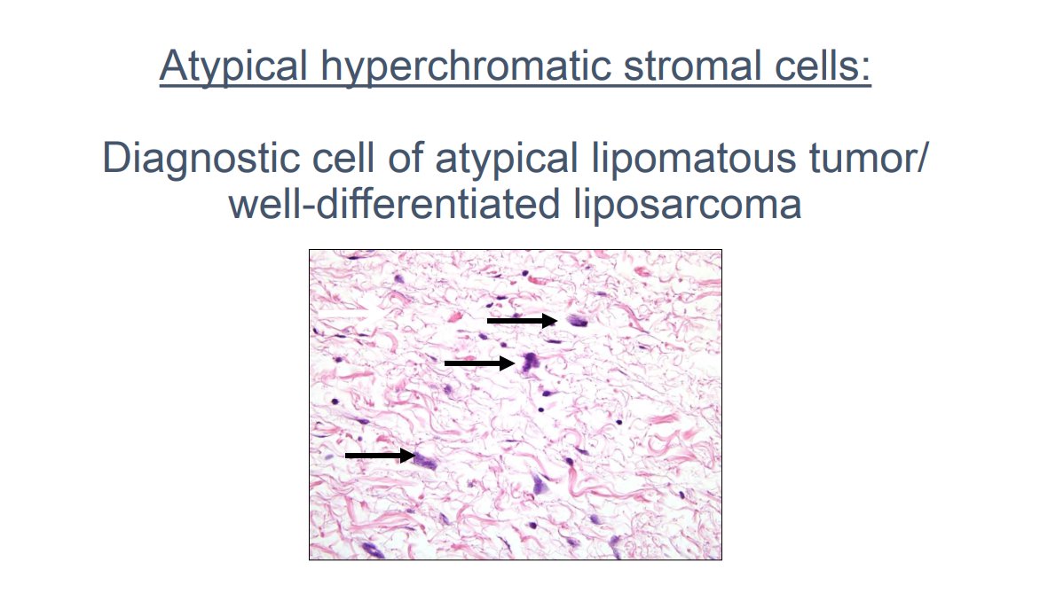 Janiranavarro's tweet photo. Rules of well differentiated lipomatous neoplasms
1. Location (pic 2)
2. Do not look for lipoblasts (pic 2), look for atypical hypercromatic cells in fibrous septa (pic 3-you can see them at 10X, if you have to go to 40X to look for them then they are not real ones)
3. Cytogenetics are often helpful in appropriate classification (pic 4)

Dr. Fritchie- Comprehensive and Immersive Soft Tissue Pathology Course-May 2025 #pathology #BSTPath #PathX