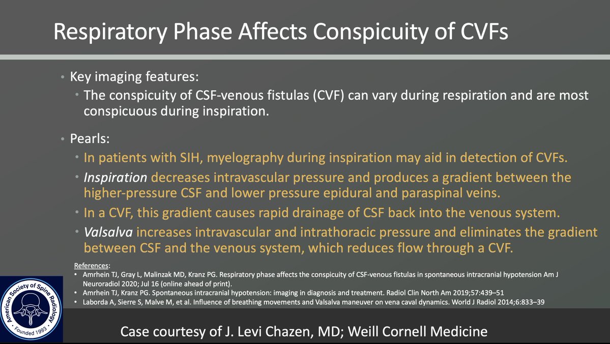 American Society of Spine Radiology (ASSR) (@the_assr) on Twitter photo ASSR COTW
History: Spontaneous intracranial hypotension (SIH) refractory to nontargeted epidural blood patches
Case c/o <a href="/TimAmrheinMD/">Tim Amrhein, MD</a> from <a href="/DukeRadiology/">Duke Radiology</a>
#SpineRad #NeuroRad #MedEd #FOAMed #FOAMrad #neuroradiology #radiology ASSR COTW
History: Spontaneous intracranial hypotension (SIH) refractory to nontargeted epidural blood patches
Case c/o <a href="/TimAmrheinMD/">Tim Amrhein, MD</a> from <a href="/DukeRadiology/">Duke Radiology</a>
#SpineRad #NeuroRad #MedEd #FOAMed #FOAMrad #neuroradiology #radiology