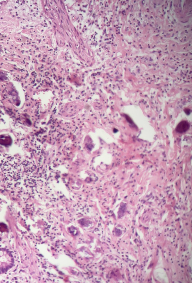 Ali Alzughbi tweet media