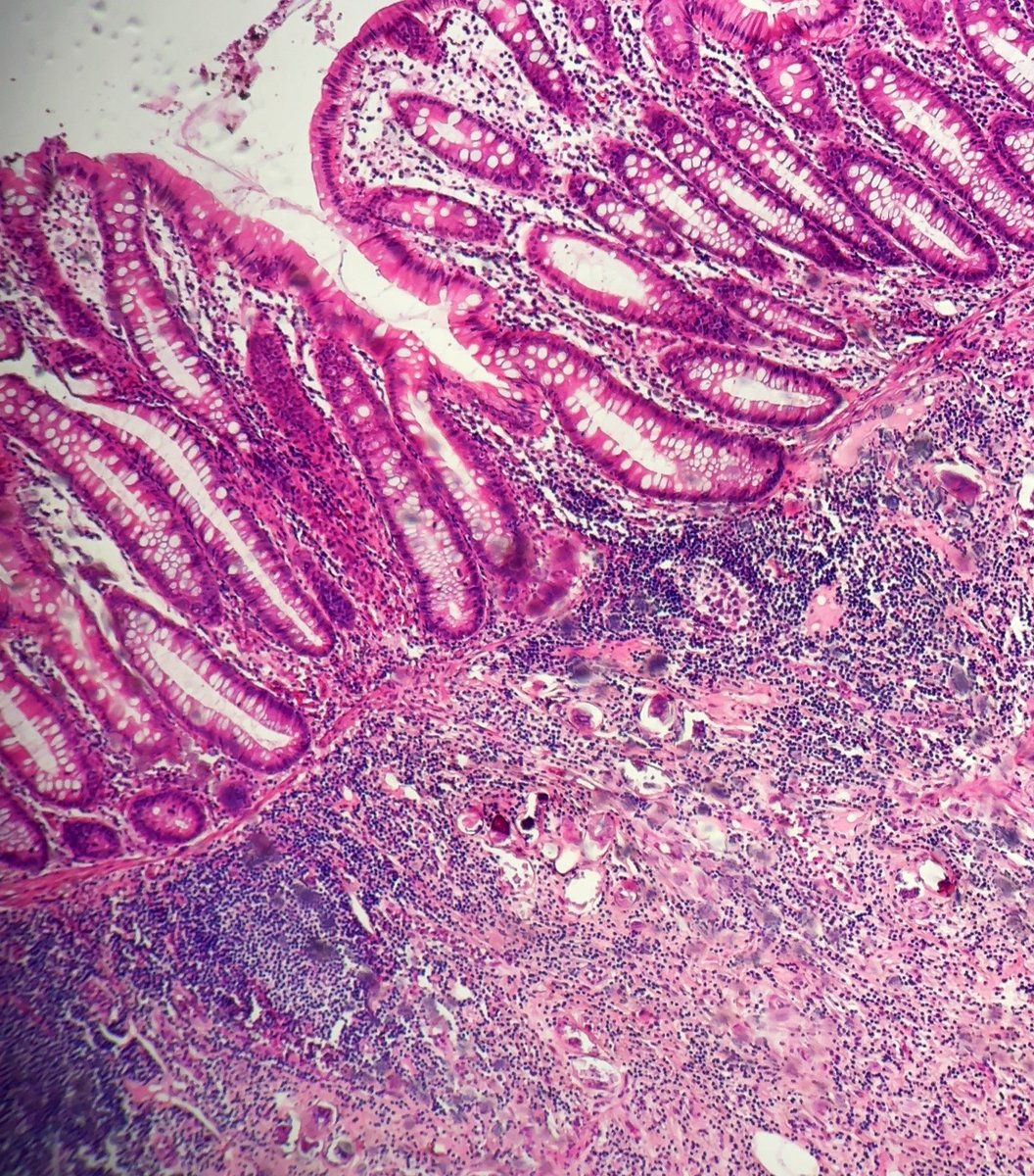 Ali Alzughbi tweet media