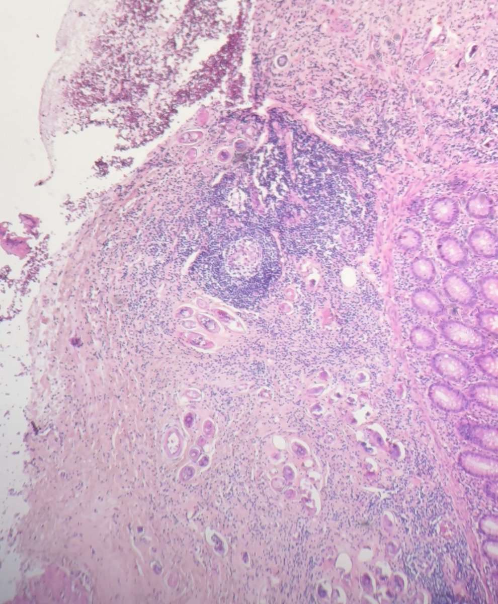 Ali Alzughbi tweet media