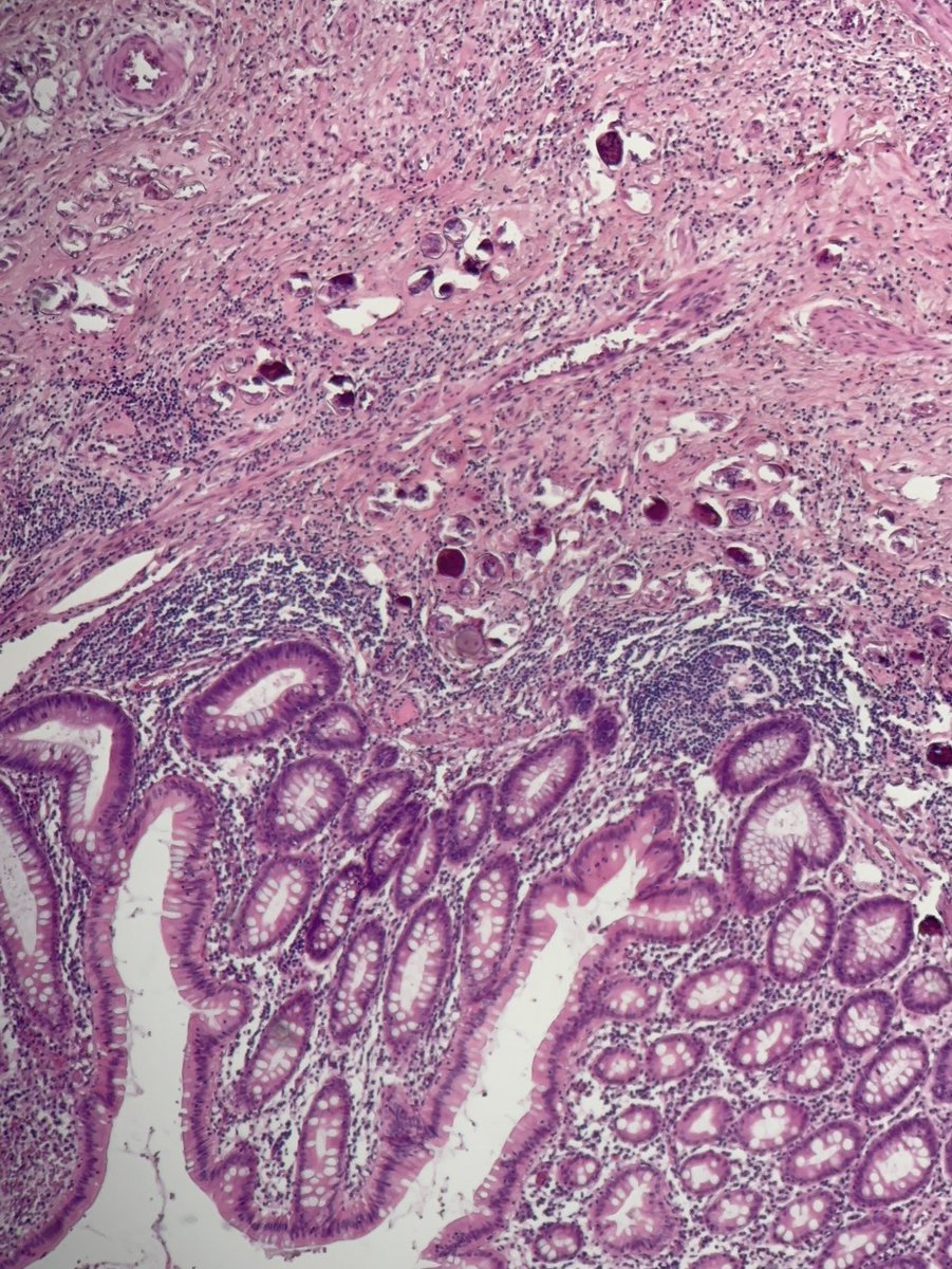 Ali Alzughbi tweet media