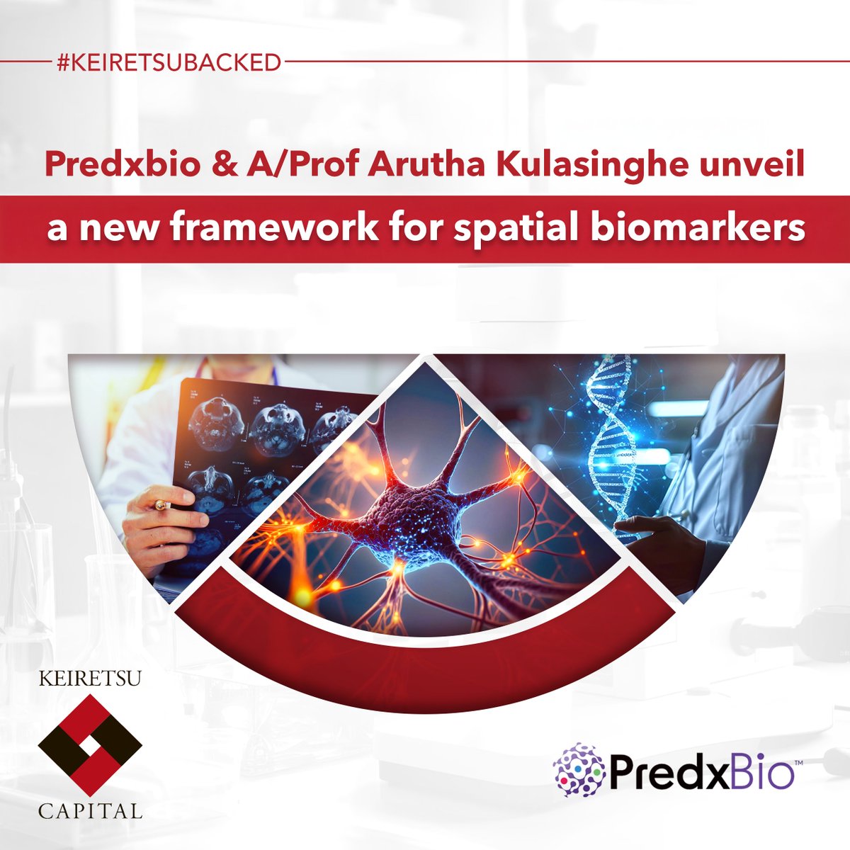#KeiretsuBacked PredxBio, with Dr. Arutha Kulasinghe &amp; Queensland Spatial Biology Centre, uses SpaceIQ™ to cut biomarker panels from 40–70 to just 1–2 markers—without losing accuracy—paving the way for faster, effective cancer diagnostics. Read More: tinyurl.com/ywtctpnv