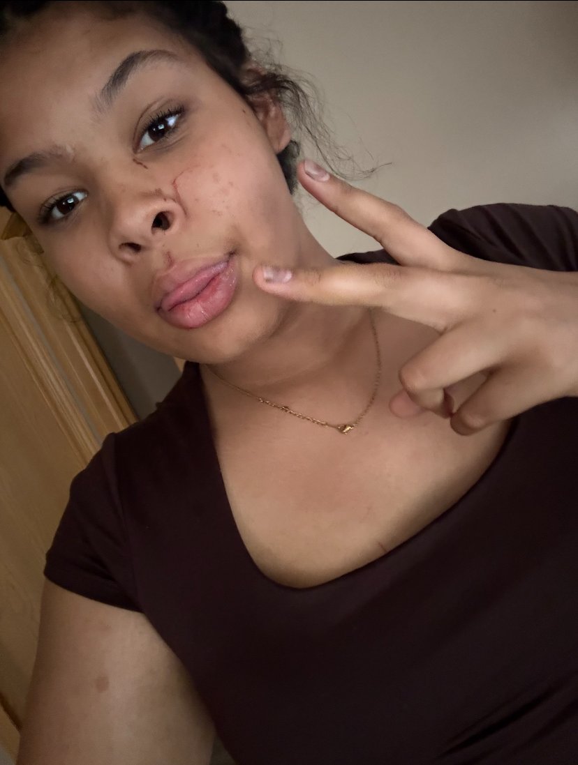 Lincoln_Police's tweet photo. 📷MISSING CHILD📷 Lincoln Police need your help locating 13-year-old Neeamani Synhorst. She was last seen August 9, around 6:00 p.m. at a home in the area of NW 6th &amp; West Saunders Street in Lincoln.
LPD case number: C5-069091 https://t.co/ZsmgKRQBlB