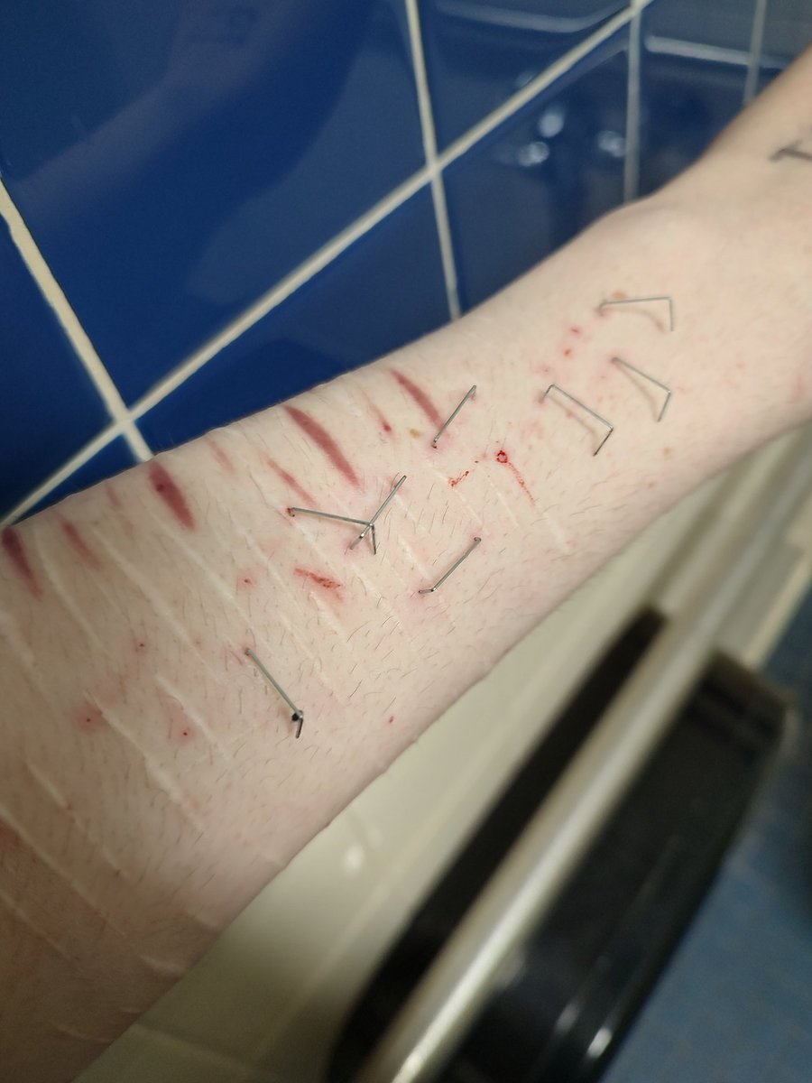 throwaway69gg's tweet photo. #shtwt more staples https://t.co/R2t1mMBV6N
