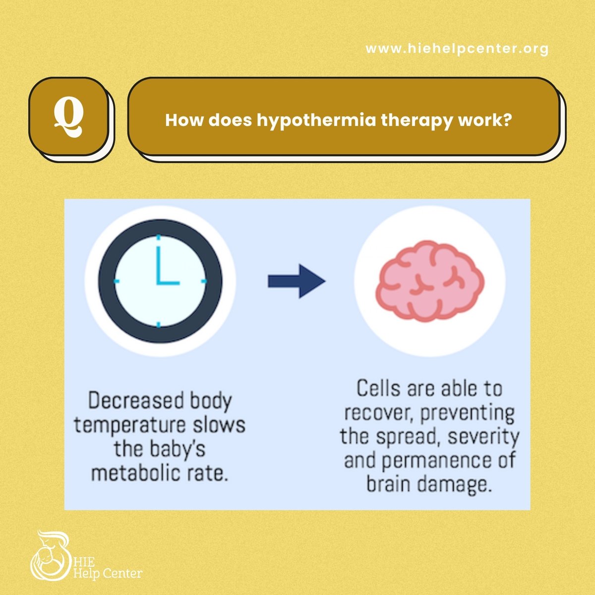 HIEHelpCenter's tweet image. Did you know cooling the body on purpose can help protect the brain after cardiac arrest or trauma?

Hypothermia therapy lowers the body’s temperature to reduce swelling, helps to prevent further injury, and gives your baby a better chance to recover. 

🔗hiehelpcenter.org/treatment/hypo…