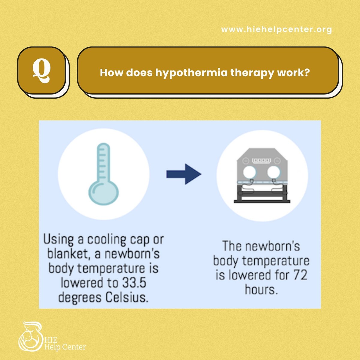 HIEHelpCenter's tweet image. Did you know cooling the body on purpose can help protect the brain after cardiac arrest or trauma?

Hypothermia therapy lowers the body’s temperature to reduce swelling, helps to prevent further injury, and gives your baby a better chance to recover. 

🔗hiehelpcenter.org/treatment/hypo…
