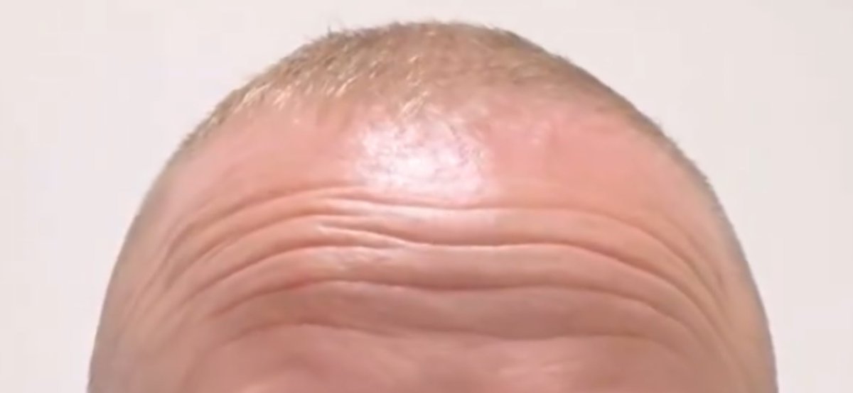 Squinter tweet media