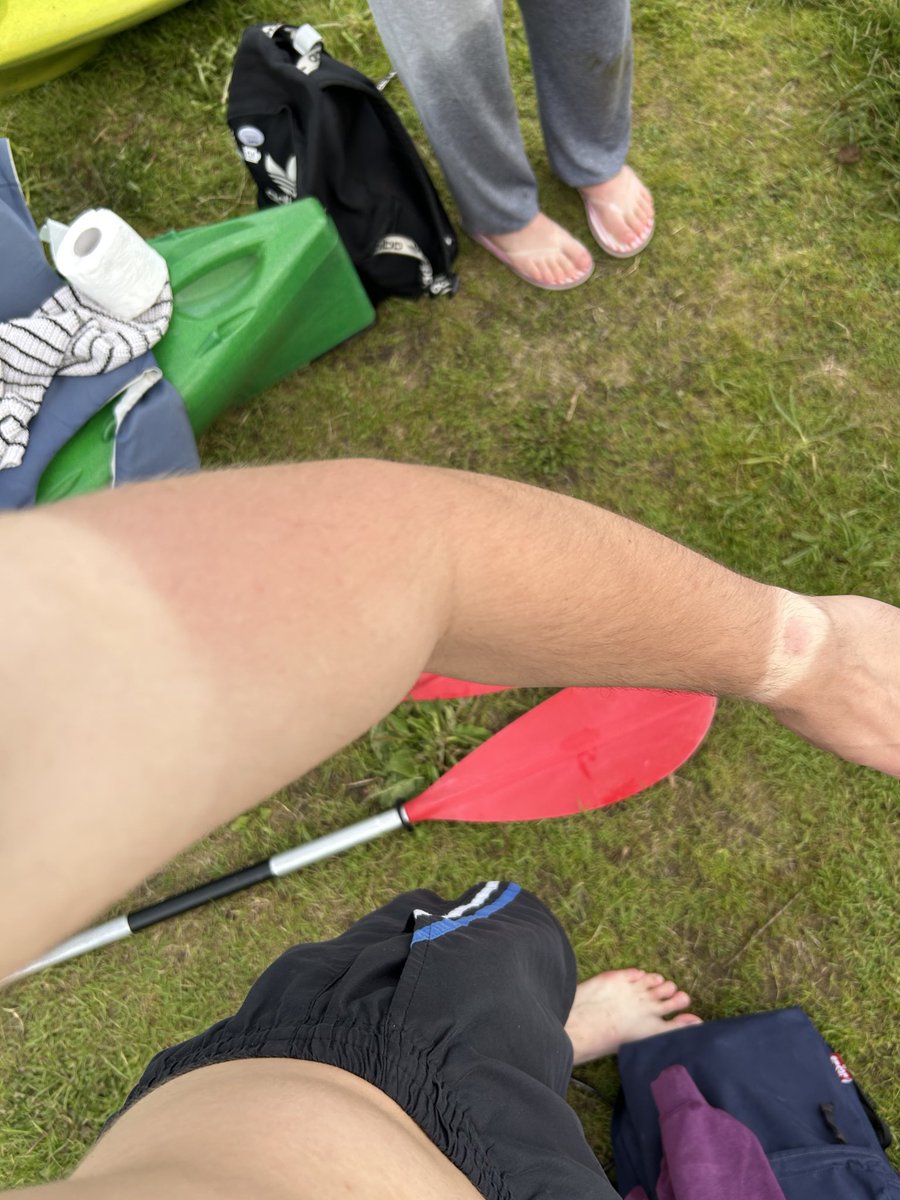 “nėra tos saulės šiandien, nieko tokio, jog pamiršau spf”:
