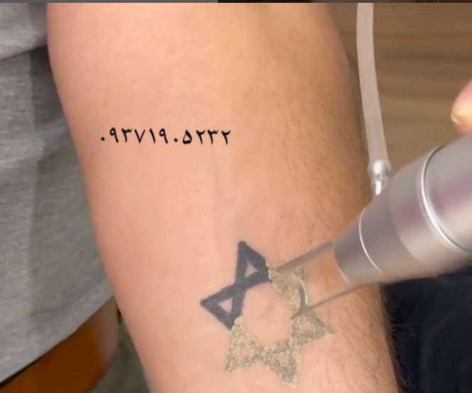 Miguel Adrover, a tattoo artist on Instagram, posted about "erasing terror" and showed himself doing tattoo removals on "hate symbols."

The symbols? A Nazi flag... and a Star of David.

Even if you were to argue that the state of Israel is just as evil as Nazi Germany (it