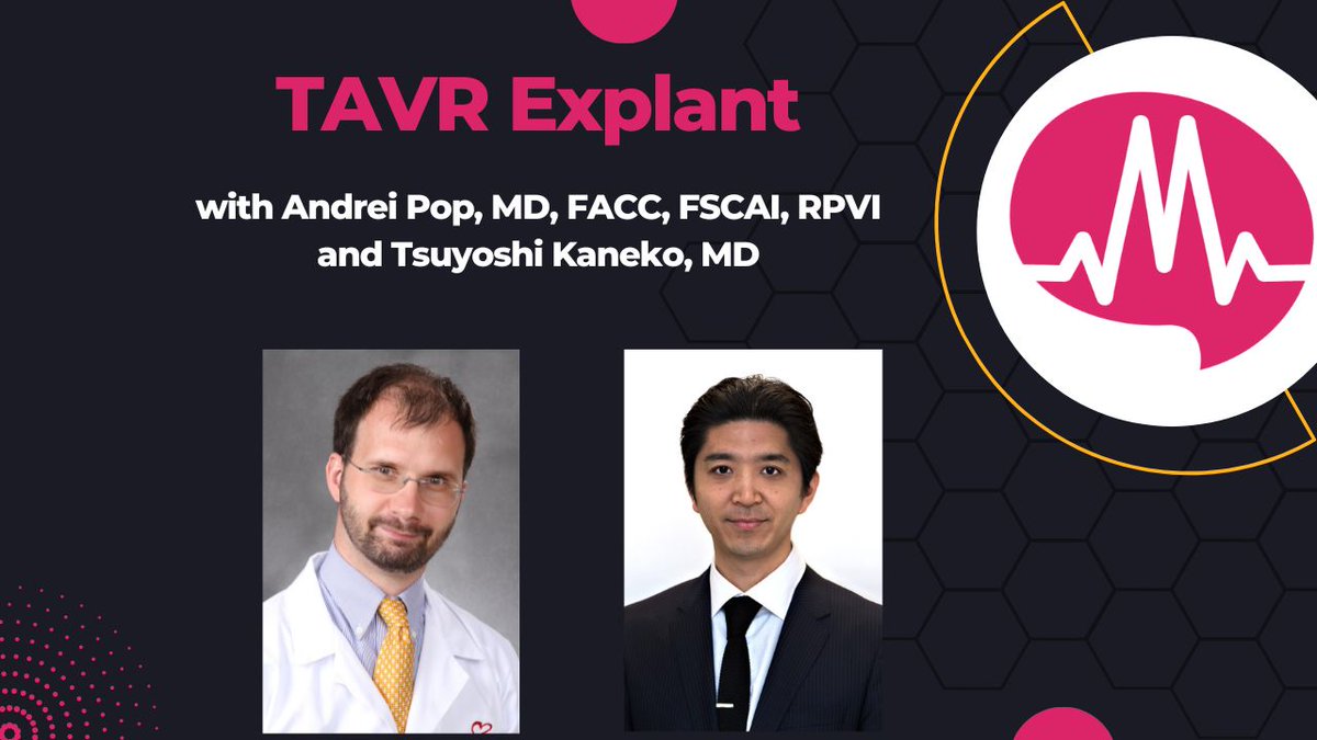 Murmur MD (@murmur_md) on Twitter photo “TAVR explant used to mean an 18% mortality rate—now it’s down to 5%. Here’s what changed.”
Join as Dr. Andrei Pop and Dr. <a href="/TsuyoshiKaneko1/">Tsuyoshi Kaneko</a> discuss TAVR Explants, why mortality rate is dropping, and how surgeons are changing the game.
Full discussion here: “TAVR explant used to mean an 18% mortality rate—now it’s down to 5%. Here’s what changed.”
Join as Dr. Andrei Pop and Dr. <a href="/TsuyoshiKaneko1/">Tsuyoshi Kaneko</a> discuss TAVR Explants, why mortality rate is dropping, and how surgeons are changing the game.
Full discussion here: