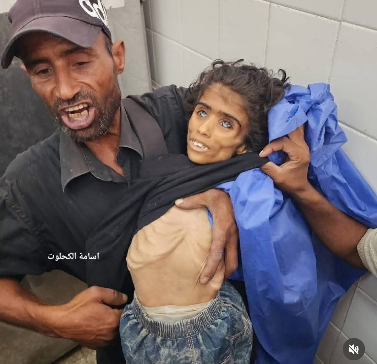 zetetic6's tweet photo. @adejoodaudu @lombaird @_JoelRayner @EYakoby I'm sorry, but you've been lied to by very evil people.  These people are ripping out your fucking soul by getting you to support stuff like in the picture below.  This is a 10 year old girl in Gaza that was deliberately starved to death: https://t.co/RaCv7tLkTP