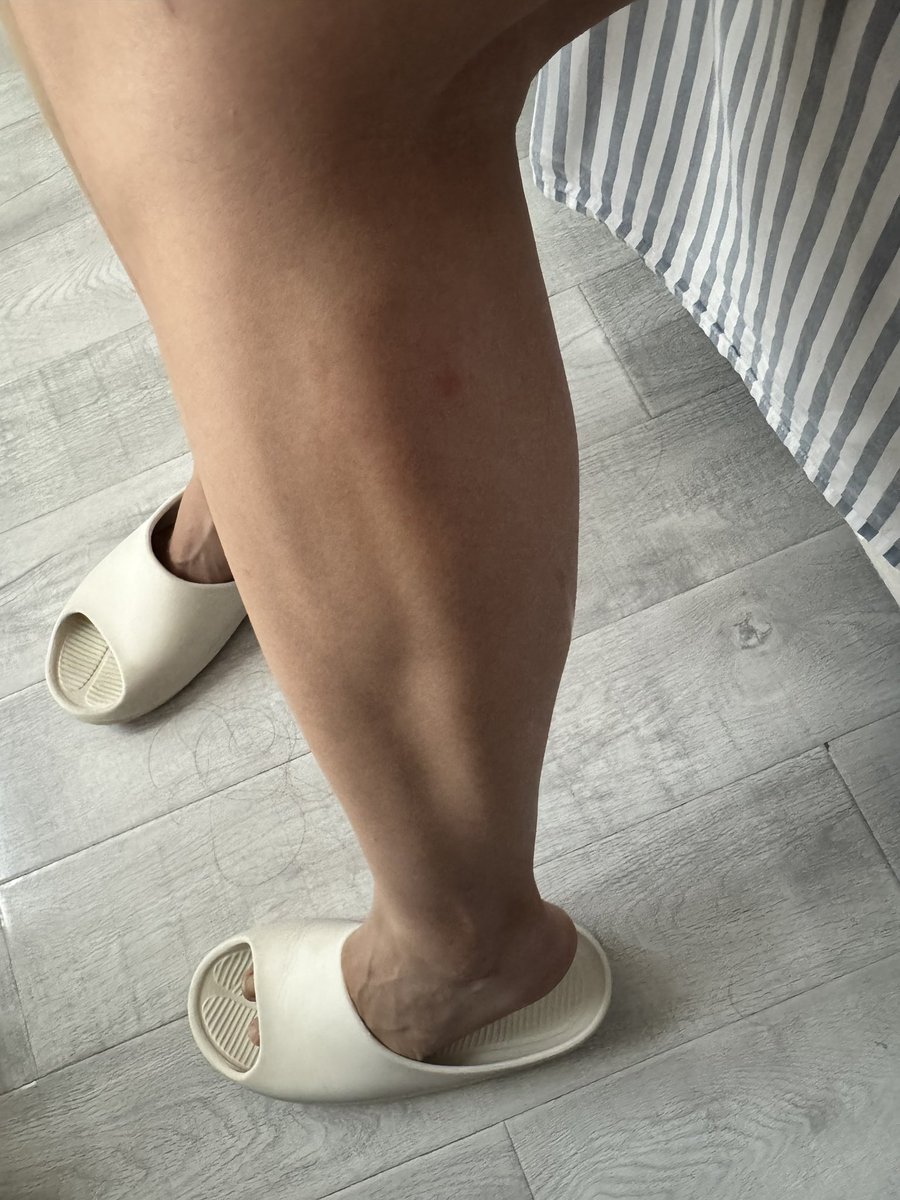 Caicai's tweet photo. 不说的话，真看不出来是女的的腿…… https://t.co/kqVnFo50zp