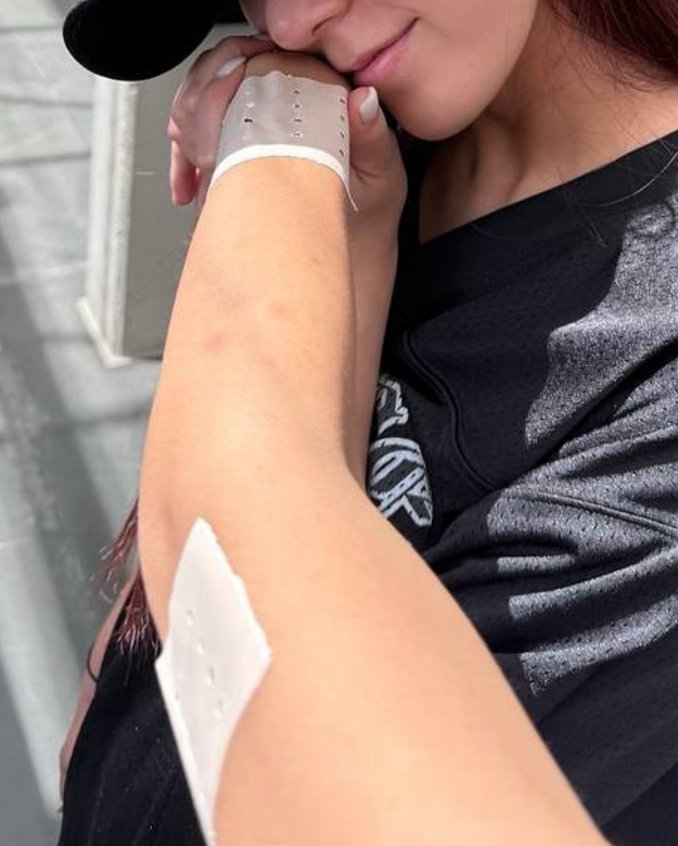 ลิซ่าบาดเจ็บที่หูก่อนเริ่มทัวร์ ระหว่างทัวร์ก็น่าจะบาดเจ็บที่แขน แต่บนเวทีมันเต็มที่มากเสิร์ฟเพอร์ฟอร์มแบบสะใจทั้งร้องทั้งเต้นเอนเตอร์เทน ทัวร์ผ่านมาเกือบครึ่งทางแล้วขออย่าบาดเจ็บเพิ่มอีกเลย🥲🙏🏻