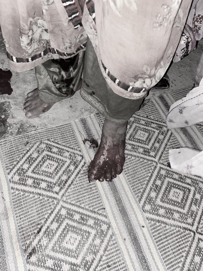 Paank condemns in the strongest possible terms the heinous grenade attack on the home of Khudad in Turbat’s Aapsar area at around 11:00 p.m. on 11 August 2025, carried out by members of Pakistan’s military death squads. This deliberate targeting of a family home left two women