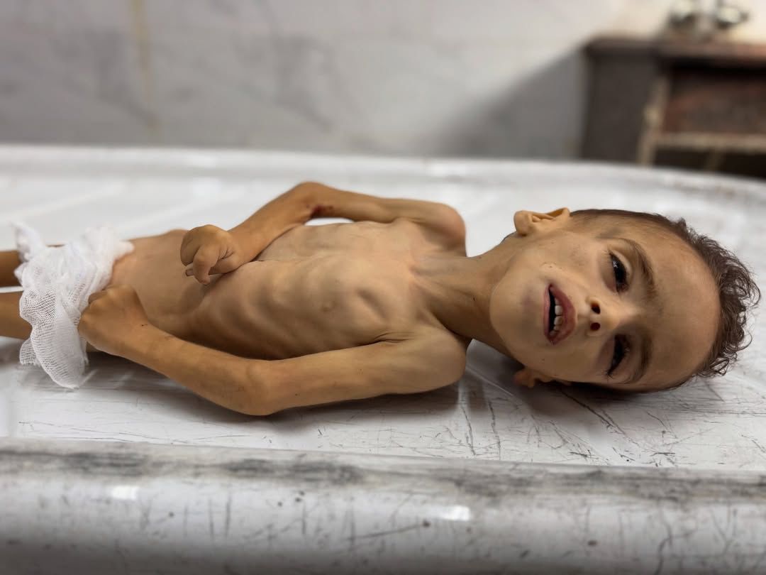 Five-year-old Mohammad Zakaria Khudr from Khan Yunis has died from extreme malnutrition after being deprived of vital medical care.

Western media wants you to think this isn't happening.

#GazaHolocaust
#GazaStarving