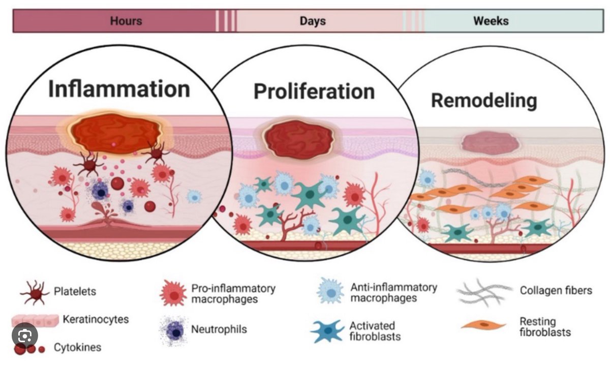 TissuesCells's tweet photo. #wound #healing https://t.co/qWAQw44XtQ