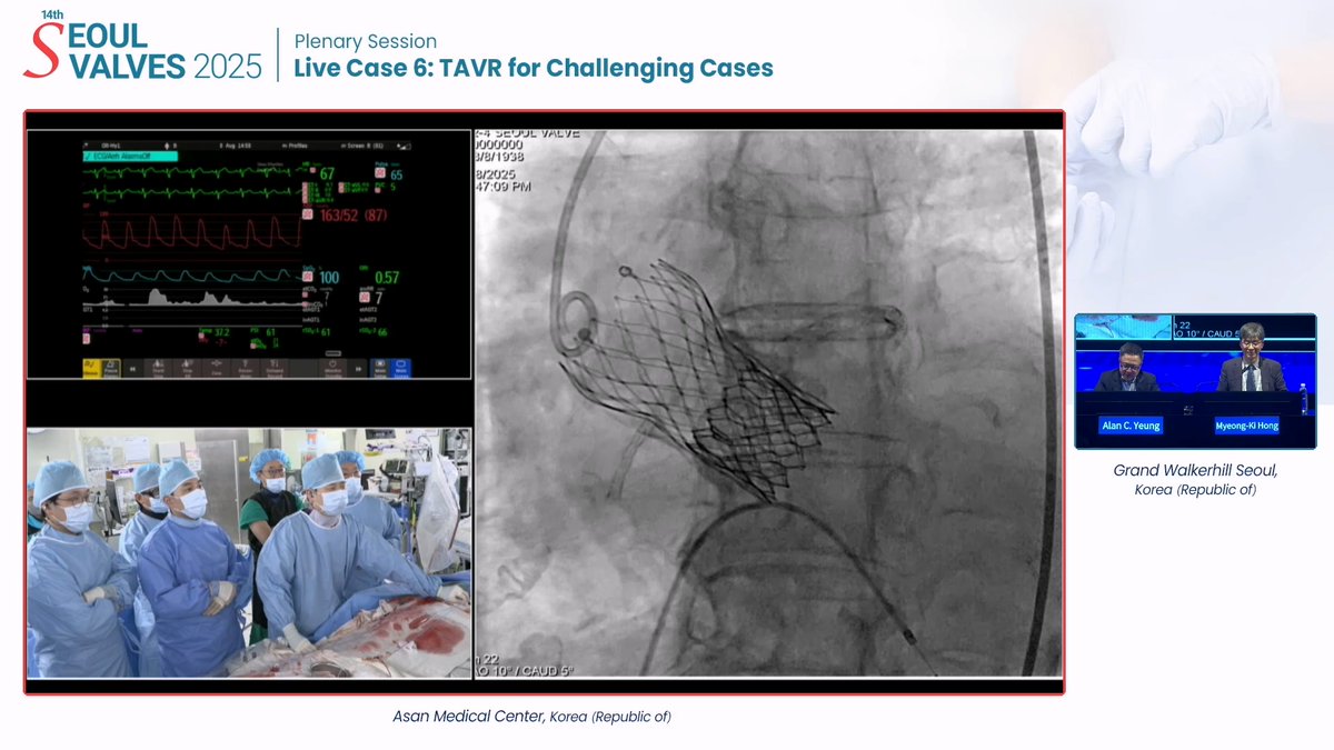 📢JUST UPDATED!
Replay the Main Arena sessions from #SEOULVALVES2025 now available for on-demand viewing. Catch up on every moment you missed!🎬

👉Watch Here: summitmd.com/html/videos.ph…