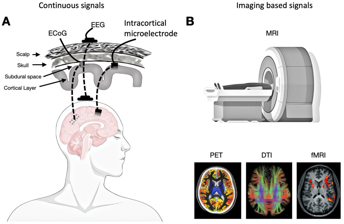 Entropy_MDPI's tweet image. 📢 Read #FeaturePaper "Entropy and Complexity Tools Across Scales in Neuroscience: A Review"
👨‍🔬 by Rodrigo Cofré(@Cofre_Rodrigo_ ) and Alain Destexhe
👉 See more details at: mdpi.com/1099-4300/27/2…

#entropy #complexity #brain #neuroscience