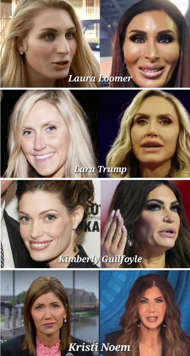 CathyNotToday2 🌿 (@cathy2nottoday) on Twitter photo <a href="/atrupar/">Aaron Rupar</a> What horrible messages we are sending to our daughters … on so many levels
This is not beauty … and certainly not character <a href="/atrupar/">Aaron Rupar</a> What horrible messages we are sending to our daughters … on so many levels
This is not beauty … and certainly not character