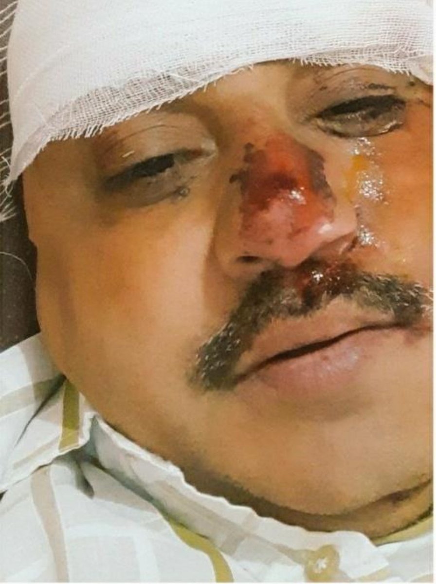 Sanatan Dharm ( Mai Hoon Modi Ka Pariwar) (@sanatandharm051) on Twitter photo <a href="/CommonBS786OM/">BITTU SHARMA- بٹو شرما</a> भूल गया क्या ? मजहब की बातें करते वक्त तूने सनातन पर क्या बोला था। उसका जबाब भी तुझे मिला था। <a href="/CommonBS786OM/">BITTU SHARMA- بٹو شرما</a> भूल गया क्या ? मजहब की बातें करते वक्त तूने सनातन पर क्या बोला था। उसका जबाब भी तुझे मिला था।