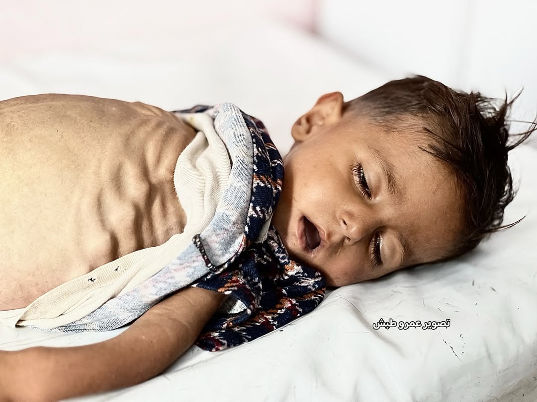 Timesofgaza's tweet photo. #GazaHolocasut https://t.co/PBbk3Jjir4