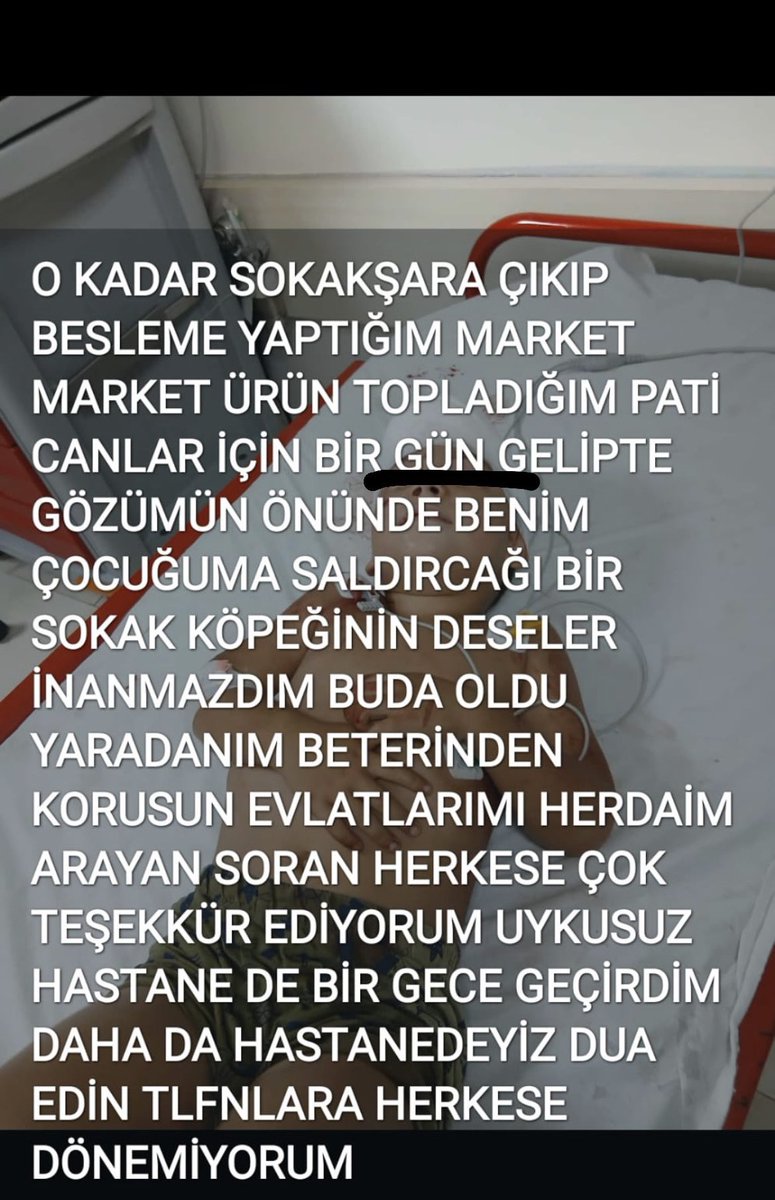 Beslediği köpekler çocuğunu ısırmış bir anne👇Ne demiştik hep başkalarının çocuğu ısırılıp ölmeyecek, belki de sıra sizinkinde😢 

#sokaktabaşıboşolmaz